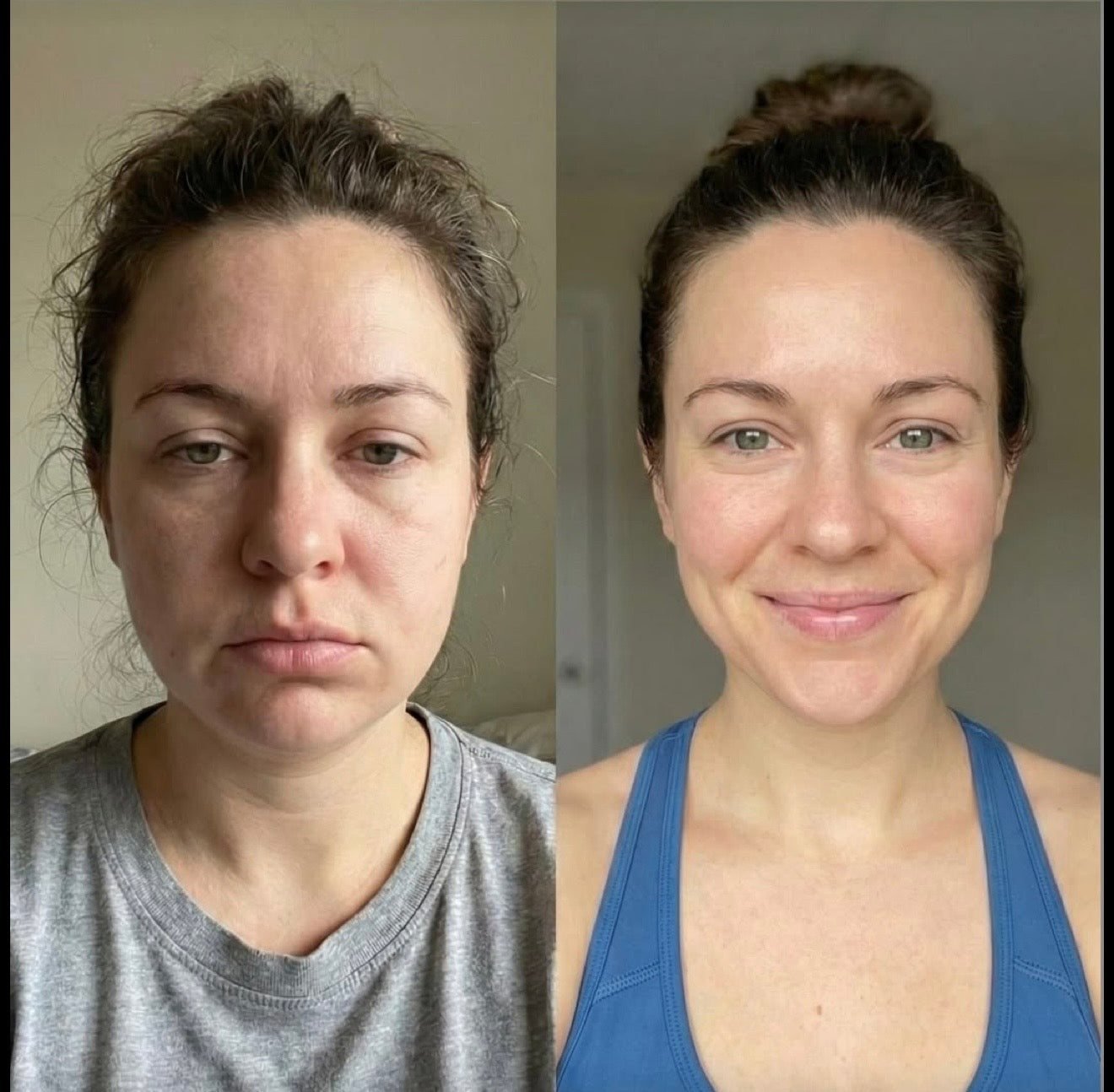 Antes y después del rostro