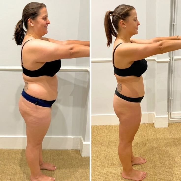 Antes y después con el cortisol en equilibrio